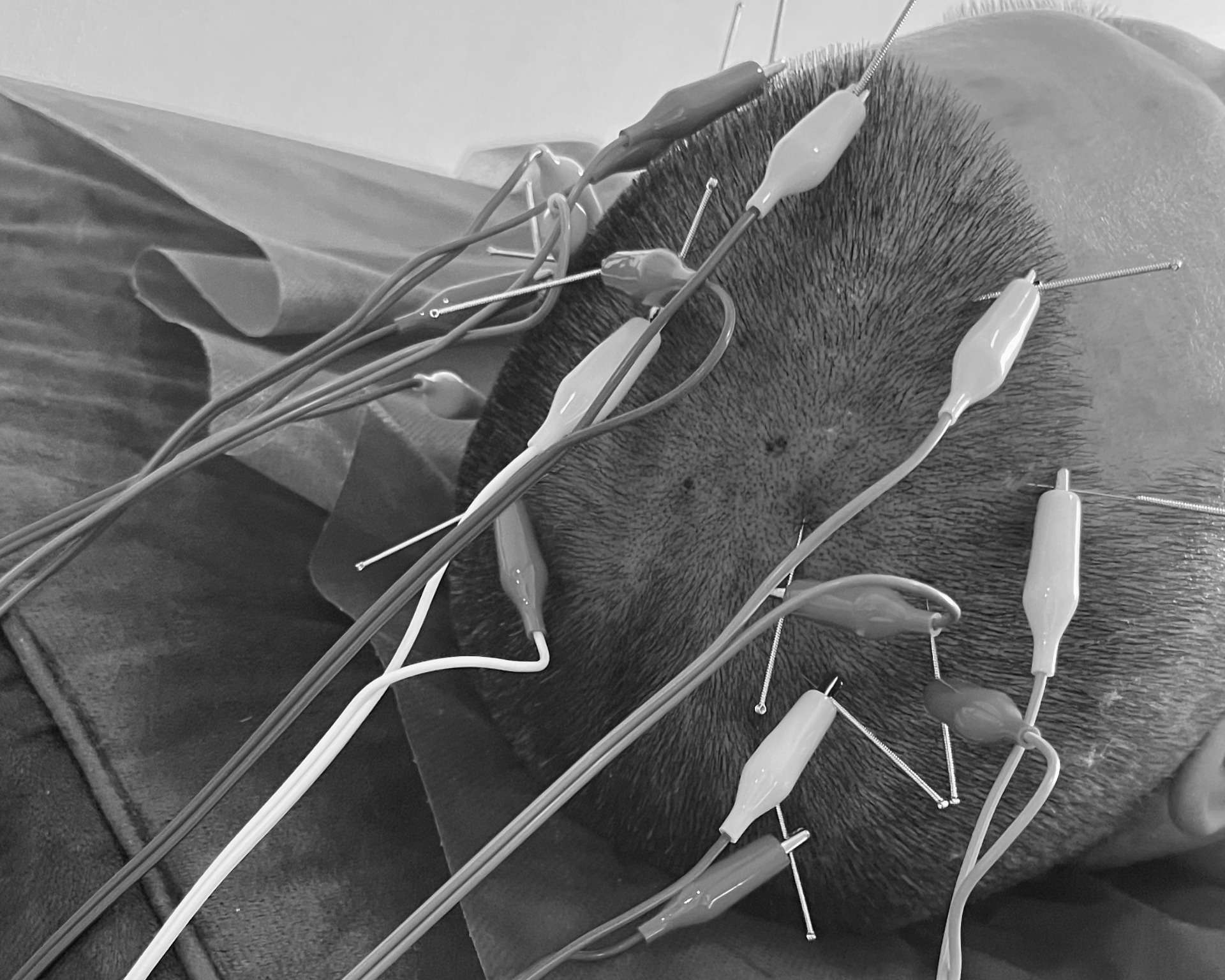 Scalp Regeneration (頭皮再生・育毛・脳疲労リセット)